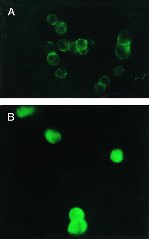 Fig. 5. Immunofluorescence microscopy indicates that CX-1 cells (A) express lower quantities of cell-surface Fas than MIP-101 cells (B). Cells were labeled with mouse anti-Fas antibody and then treated with antimouse FITC-conjugated antibody. Note that CX-1 cells (A) show a discontinuous ring of fluorescence on their cell surface; in contrast, MIP-101 cells (B) stain very intensely with secondary antibody.