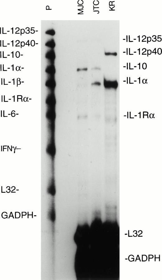 Fig. 3. Ribonuclease protection assay for cytokine mRNA synthesis by EBV-transformed MJC, JTC, and KR LCL. RNA was extracted from LCL during log-phase growth, and aliquots from 106cell-equivalents were analyzed with the hCK-2 probe set (PharMingen). Lanes containing untreated probes (P) and mRNA-protected probes (MJC, JTC, and KR) are shown. Ribosomal L32 and GADPH are cellular housekeeping mRNAs. The autoradiogram was from 24 hours of exposure.