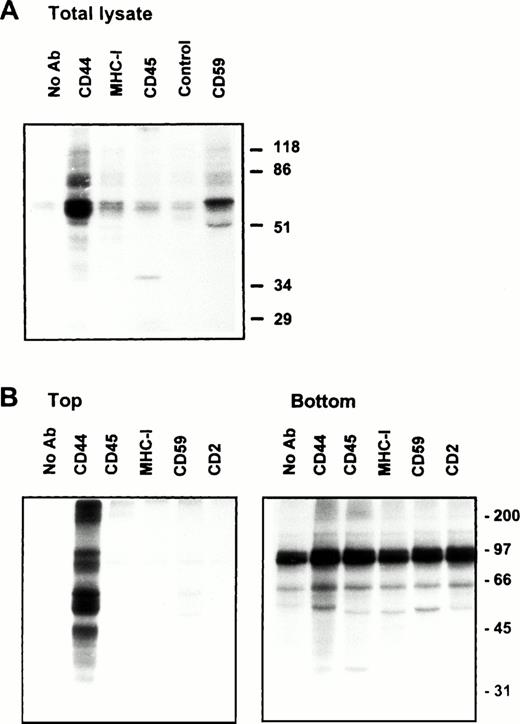 Fig. 5. Kinase activities associated with CD44 are localized in low-density plasma membrane domains. (A) One milliliter of total Brij-58 lysate from 10 ×106 PBMC was precleared with Pansorbin and immunoprecipitated on protein A/G beads coated with indicated antibodies or a control MoAb (against hapten TNP) and blocked subsequently with FCS. After washing, the beads were assayed for the associated kinase activity at 30°C for 15 minutes. The reaction was stopped by boiling in sample buffer, and the phosphorylated proteins separated by SDS-PAGE were detected by autoradiography. (B) After gradient centrifugation of the Brij-58 extract as in Fig 1, the top (3 through 5) and bottom (9 through 11) fractions were pooled separately. The bottom pool containing 80% of the cellular proteins was diluted four times to equalize the protein concentration. Immunoprecipitation with indicated antibodies from the pooled top or bottom fractions and kinase reaction were performed as in (A). The autoradiograms were obtained after overnight exposure at room temperature. Similar results were obtained with PHA blasts (not shown). Kinase activities associated with CD44 are better preserved in whole lysates or gradient top fractions when Brij-58 was used; experiments with TX-100–lysed samples required a much longer exposure time, but showed an identical phosphoprotein profile (not shown).