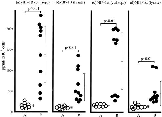 Fig. 3. Spontaneous MIP-1β and MIP-1α production from ATL cells. The cytokine levels in culture supernatants (a and c) collected from normal CD4+ T cells (group A) and the ATL cells (group B) after 24 hours of incubation at 37°C without any stimulation or cytosol (b and d) of normal CD4+ T cells (group A) and ATL cells freshly obtained from peripheral blood of ATL patients (group B) were determined by MIP-1β (a and b) and MIP-1α (c and d) ELISA system. Each point represents the concentration of MIP-1β and MIP-1α in the lysate or supernatant derived from 1 × 105 cells of individual subjects. Bars represent the mean ± SD of each group (Student's t-test).