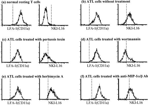 Fig. 6. Staining for the activated form of LFA-1α (CD11a) on peripheral ATL cells using NKI-L16 MoAb. Peripheral normal T cells (a) and ATL cells (b through f) were pretreated with or without 1 μg/mL pertussis toxin for 1 hour at 37°C (c), 100 nmol/L wortmannin (d), 10 μmol/L herbimycin A (e), or a mixture of anti–MIP-1α and anti–MIP-1β Abs (f) for 2 hours at 37°C. The cells were subsequently stained with CD11a MoAb TS1/22 or NKI-L16 MoAb. Cells in the CD4 and CD45RO gate (triple fluorescence) were analyzed by using a flow cytometer. Representative histograms from each one of the volunteers or patients are shown.