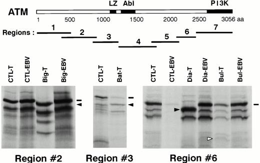 Fig. 3. Mutation screening by PTT. Upper panel, schematic representation of the ATM protein with its presently known domains. LZ: putative leucine zipper domain, Abl: Abl-binding region, PI3K: phospho-inositol 3 kinase family domain. The seven regions analyzed by PTT are shown in relation to the ATM protein. A scale is shown in aa. Lower panel, PTT analysis of the three regions showing abnormal patterns. CTL-T: T-PLL sample showing a normal pattern. CTL-EBV: corresponding EBV-transformed cell line sample. Big-T, Bat-T, Dia-T, Bul-T: T-PLL samples showing abnormal patterns. Big-EBV, Dia-EBV, Bul-EBV: corresponding EBV-transformed cell line samples. Dashes indicate wild-type full-length products and arrows indicate abnormal bands.