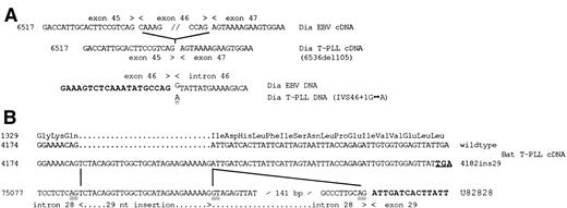 Fig. 4. Analysis of ATM mutations. (A) Exon skipping in patient “Dia”. Upper panel, normal partial cDNA sequence demonstrated in the “Dia” EBV cell line sample as compared with the tumor cDNA sequence, which is deleted for the 105-bp of exon 46. Lower panel, genomic sequence of germline (EBV) and tumor (T-PLL) DNAs. Exon 46 sequence is indicated in bold. The G>A mutation is double underlined. (B) Insertion of 29 nt in tumor DNA from patient “Bat”. Tumor cDNA sequences contained, in approximately equal amounts, wild-type and mutated (4182ins29) sequences. The normal corresponding peptide sequence is indicated. The stop codon due to the frameshift as a consequence of the 29 nt insertion is indicated in bold and underlined. Lines indicated the correspondence between the mutated cDNA sequence and the normal published genomic sequence (accession number U82828). The genomic sequence of “Bat” tumor DNA was identical to the published one. The putative splice donor and acceptor sites on each side of the 29 nt insertion are doubly underlined, and the exon 29 sequence is indicated in bold. Numbering of nucleotides is based on either the ATM transcript sequence (accession number U33841) for the cDNA, or on the full-length ATM gene sequence (accession number U82828) for the genomic DNA.2532Numbering of codons starts at the initiating ATG.
