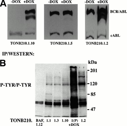 Fig. 6. Molecular analysis of doxycycline-independent tumors. (A) Western blot analysis to detect expression of BCR/ABL in representative doxycycline-independent tumor cell lines grown in the absence or presence of doxycycline. Constitutive cABL expression is also shown. (B) Immunoprecipitation/Western blot analysis of downstream signaling from doxycycline-independent tumor cells. Protein lysates from doxycycline-independent tumor cell lines grown in the absence of IL-3 and doxycycline were immunoprecipitated with an anti-phosphotyrosine antibody followed by Western blot analysis with the same antibody (P-TYR/P-TYR). Parental TonB210.1 cells grown in the presence of doxycycline were also analyzed (1(P) +DOX). Size markers are indicated at right.