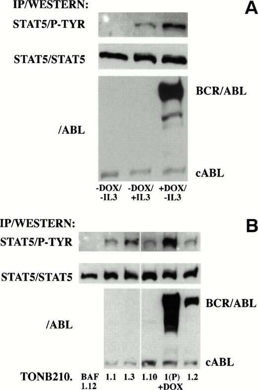 Fig. 7. Analysis of downstream signaling of BCR/ABL through STAT5 in doxycycline-dependent (A) and -independent (B) cells. (A) Protein lysates from serum-starved doxycycline-dependent TonB210.1 cells in the absence of doxycycline and without IL-3 stimulation (−DOX/−IL3), absence of doxycycline pulsed with IL-3 (−DOX/+IL3), or presence of doxycycline in the absence of IL-3 stimulation (+DOX/−IL3) were immunoprecipitated with an anti-STAT5 antibody followed by Western blot analysis with an anti-phosphotyrosine antibody (STAT5/P-TYR). Blots were stripped and reprobed with an anti-STAT5 antibody (STAT5/STAT5). Total lysates were also Western blotted with an anti-ABL antibody (/ABL) for detection of BCR/ABL and constitutive cABL expression. (B) Protein lysates from doxycycline-independent tumor cell lines grown in the absence of IL-3 and doxycycline were immunoprecipitated with an anti-STAT5 antibody followed by Western blot analysis with an anti-phosphotyrosine antibody (STAT5/P-TYR). Parental TonB210.1 cells grown in the presence of doxycycline were also analyzed (1(P) +DOX). Blots were stripped and reprobed with an anti-STAT5 antibody (STAT5/STAT5). Total lysates were also Western blotted with an anti-ABL antibody (/ABL) for detection of BCR/ABL and constitutive cABL expression.
