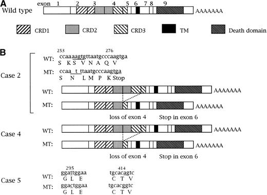 Fig. 5. Abnormalities of the Fas gene in ATL cells. (A) Structure of the human Fas gene. The three cysteine-rich domains (CRDs), transmembrane domain (TM), and death domain are shown. (B) Mutations of the Fas genes in cases no. 2, 4, and 5. Detected Fas gene mutations are shown.