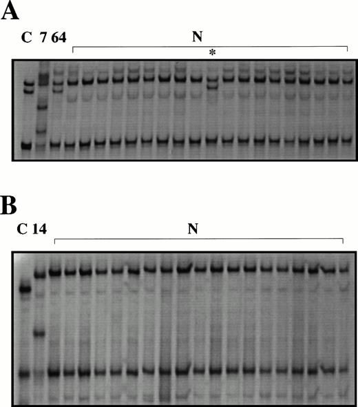 Fig. 1. Abnormal SSCP patterns are found in some pediatric T-cell leukemias. PCR-SSCP analysis of exon 3 (A) and the proximal promoter (B) of CD95. C, normal human genomic DNA amplified using a mutant primer with a single base mismatch (positive control);7,14,64, patient leukemias; N, peripheral blood from healthy controls. Abnormal migrating bands are seen in the positive controls, the leukemias and in one healthy control (*).
