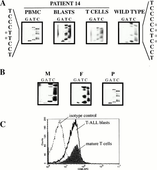 Fig. 3. Mutation analysis of patient 14. (A) Homozygous germline mutation in the promoter of CD95 causing disruption of a consensus sequence for AP-2 binding. Genomic DNA of PBMC was amplified by PCR using primers 1-1F/1-1R (covering nt −408 to nt −202 of the CD95 promoter; nucleotides numbered relative to the ATG start codon according to Behrmann et al41). The amplificate was subjected to SSCP analysis, abnormal migrating bands were cut-out from the gel, reamplified, and sequenced. T-ALL blasts and mature T lymphocytes were immunomagnetically purified, PCR-amplified as above, and sequenced. Nucleotide sequence is compared to wild type. Bases involved in the mutation are highlighted by asterisks. (B) The mutation is inherited from the father. Genomic DNA of PBMC from the mother (M), the father (F), and the patient (P) were amplified as under (A).The mutation is inherited from the homozygous father, whereas the mother has wild-type alleles only. (C) The mutation in the CD95 promoter does not decrease constitutive CD95 expression. CD95 expression on cryopreserved PBMC was determined by three-color immunofluorescence analysis as described in Materials and Methods. For electronic gating T-ALL blasts were identified by forward/side scatter characteristics of viable lymphocytes and surface expression of CD7 but not CD3. Mature T cells were CD3+ and CD7+.