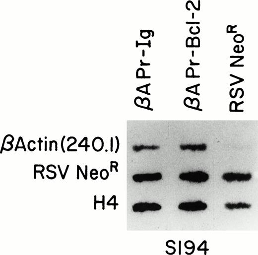 Fig. 3. Run-on assays showing equal transcriptional activity ofβAPr-Bcl-2 and βAPr-Ig constructs in stable transfectants of a mouse B-cell line. Nascent, labeled RNA extracted from S194 cell lines transfected with βAPr-Bcl-2, βAPr-Ig,or only the RSVneo vector was hybridized to DNA probes detecting the human β-actin RNA produced by the Bcl-2 and Ig constructs (upper row), the RSVneo RNA produced by all three cell lines transfected with the neomycine resistance gene (middle row), and the mouse histone H4 gene integral to the S194 cell line (lower row). The 145-nt β-actin fragment (p240.1) is specific for the βAPr-constructs and is therefore only seen in lanes 1 and 2.