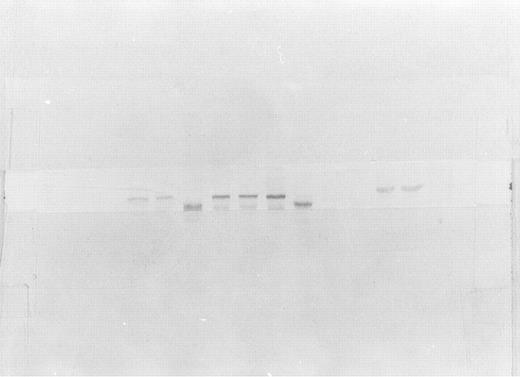Fig. 2. Western blot analysis of exon deletion ferrochelatase mutants. Cell extracts of the exon deletion and wild-type human ferrochelatases containing about 5 μg were separated by SDS-polyacrylamide gel electrophoresis, transferred to a nitrocellulose membrane, and treated with human ferrochelatase antiserum. Procedures are as stated in Materials and Methods. From right to left, lanes 1 and 2, wild-type human ferrochelatase used as control; lanes 3 through 11, ▵exon 3 through ▵exon 11 in sequential order. Exons 3 and 4 are believed to contain the epitope for antibody recognition. The size differences of these proteins are evident as the mature-length wild-type human ferrochelatase (from pHDTF20) has a molecular weight of 42 kD and contains 363 amino acid residues, ▵exon 5 contains 320 residues, ▵exon 6 contains 331 residues, ▵exon 7 contains 333 residues, ▵exon 8 contains 330, ▵exon 9 contains 310, ▵exon 10 contains 347, and ▵exon 11 contains 318 residues.