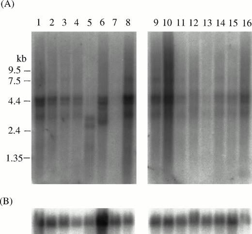 Fig. 3. Northern blot analysis of the expression of MTG16in human tissues. Northern blot filters from human adult tissues (Clontech) were used for analysis. Probes: (A), whole MTG16a cDNA (nucleotides 1 to 4227); (B), G3PDH. Lanes 1, heart; 2, brain; 3, placenta; 4, lung; 5, liver; 6, skeletal muscle; 7, kidney; 8, pancreas; 9, spleen; 10, thymus; 11, prostate; 12, testis; 13, ovary; 14, small intestine; 15, colon; 16, peripheral blood leukocyte.