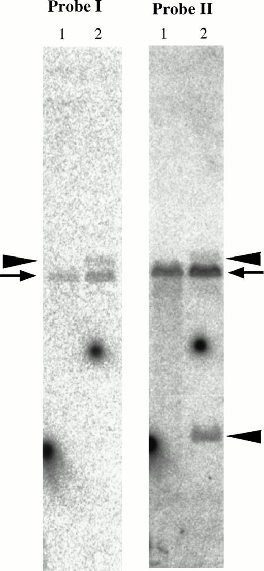 Fig. 8. Southern blot analysis of the MTG16 gene. Genomic DNAs were digested with EcoRI and hybridized with probe I and II shown in Fig 4. Probe I; the PCR-amplified 434-bp genomic fragment using the primers 124r5R1 and MTG16r5. Probe II; theEagI-EcoRI 2-kb fragment. Rearranged bands (15-kb band derived from der(21) chromosome and 3.7-kb band derived from der(16) chromosome) and germline bands (12 kb) are shown by arrowheads and an arrow, respectively. Lane 1, a human normal leukocyte cell line C496 was used as a control; lane 2, patient no. 1.