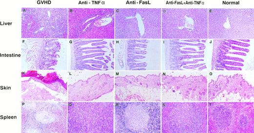 Fig. 2. Histopathological examination. Induction of lethal acute GVHD and administration of anti-FasL and/or anti-TNFα MoAb were performed as described in Fig 1. On day 19 for the GVHD group or day 21 for the other groups, 3 mice in each group were killed. Paraffin section of the liver (A through E), intestine (F through J), skin (K through O), and spleen (P through T) were stained by hematoxylin and eosin. Sections from age-matched normal CBF1 are also represented. The specimens shown are representatives of 3 mice in each group with similar histology. Original magnification × 100.