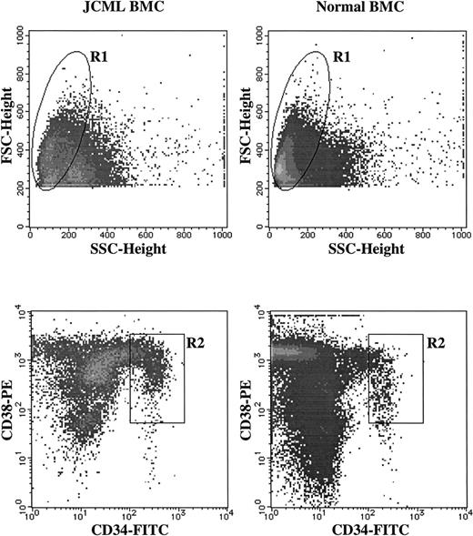 Fig. 1. Sorting of CD34+CD38+ cells from JCML and normal BM MNCs. BM MNCs were stained with FITC-conjugated anti-CD34 MoAb and PE-conjugated anti-CD38 MoAb. As negative controls, FITC- and PE-conjugated mouse IgG1 were used. The lymphocyte/blast region (R1) were gated according to their FSC and SSC. The cells in the R2 region were sorted as CD34+CD38highcells.
