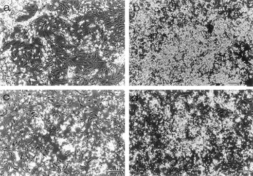 Fig. 2. Morphology of LTBMCs obtained from 7-week-old mice. Dexter's cultures of TN-C–deficient mice (a) and of control mice (b) were photographed under an inverted microscope at week 25 after culturing. Large hematopoietic foci were seen in the control culture. Whitlock-Witte's cultures of TN-C–deficient mice (c) and of control mice (d) were photographed at week 15. Bar, 100 μm. Significant decrease in hematopoietic activity was observed in LTBMCs of TN-C–deficient mutant mice.