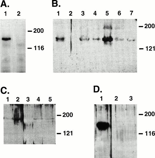 Fig. 3. Immunoprecipitates of biotinylated 3T3 cells to detect surface expression of Jagged (A) and Westerns of hematopoietic cell lysates to detect expression of Jagged-1 (B, C, and D). (A) Lysates were prepared from 3T3 cells infected with a retroviral vector containing sequences encoding full-length human Jagged-1 (lane 1) or parental 3T3 cells (lane 2) that had been previously biotinylated to label surface proteins. Lysates were immunoprecipitated with 9E10 antibody and resulting proteins were separated on an 8% SDS-PAGE, transferred to nitrocellulose, and probed with HRP-streptavidin and developed using ECL. (B) Protein lysates were prepared from a 3T3 cell line expressing Jagged-1 (lane 1), a parental 3T3 cell line (lane 2 ), and murine hematopoietic stromal cell lines AFT024, CFC034, 2058, 2012, and 2018 (lanes 3 through 7, respectively). (C) Protein lysates were prepared from a 3T3 cell line expressing Jagged(lane 1), primary cultured murine fetal liver stoma (lane 2), murine BM cells (lane 3), primary cultured BM stroma from C57BL/6J (lane 4), and from Balb-C mice (lane 5). (D) Protein lysates were prepared from a 3T3 cell line expressing Jagged (lane 1), Ficoll-Hypaque–separated murine BM cells (lane 2), and sorted precursors (Lin−Sca-1+c-kit+) (lane 3). For gels in (B), (C), and (D), proteins were separated with either an 8% SDS-PAGE (B and D) or a 6% SDS-PAGE (C), transferred to nitrocellulose, and probed with SER10, a polyclonal antibody raised against C-Serrate 1.