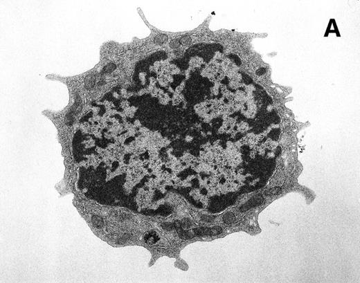 Fig. 8. Ultrastructural analysis of isolated Rh-123low (A) and Rh-123high (B) HSC. The original magnification was 8,200X in each case. Pronounced mitochondrial clustering is apparent in the nuclear cleft region of the Rh-123high cell (B), correlating with the bipolar perinuclear localization of Rh-123 staining seen in Fig 7B. Activated mitochondria in (B) can be identified by increased electron density due to thickening of cristae and by the characteristic structural collapse and “wagon wheel” appearance of actively respiring mitochondria; these features were rarely noted in micrographs of Rh-123low cells (A). The micrographs are representative of 17 images of Rh-123low cells and 32 images of Rh-123high cells.