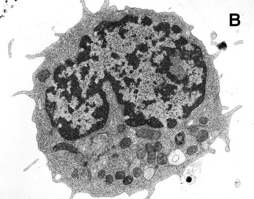 Fig. 8. Ultrastructural analysis of isolated Rh-123low (A) and Rh-123high (B) HSC. The original magnification was 8,200X in each case. Pronounced mitochondrial clustering is apparent in the nuclear cleft region of the Rh-123high cell (B), correlating with the bipolar perinuclear localization of Rh-123 staining seen in Fig 7B. Activated mitochondria in (B) can be identified by increased electron density due to thickening of cristae and by the characteristic structural collapse and “wagon wheel” appearance of actively respiring mitochondria; these features were rarely noted in micrographs of Rh-123low cells (A). The micrographs are representative of 17 images of Rh-123low cells and 32 images of Rh-123high cells.