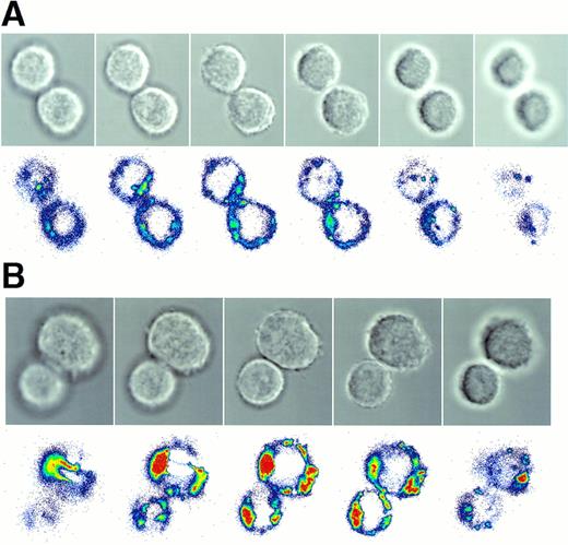 Fig. 7. Laser-scanning confocal microscopy of isolated Rh-123low (A) and Rh-123high (B) HSC. In each pair of images, the top frame was captured from transmitted light, while the bottom frame was a simultaneous fluorescent image. Identical magnifications (63X oil objective), illumination, and signal processing conditions were used to image the two cell types, assuring that the images are representative of the differential size and fluorescence intensity of the cells. Fluorescence images were inverted and pseudocolored so that increasing fluorescence intensity is indicated from blue to red. Note the relatively homogeneous cytoplasmic staining in the Rh-123low cells compared with the intense bipolar perinuclear staining seen in Rh-123high cells. The images are representative of 38 Rh-123low cells and 28 Rh-123high cells evaluated in two separate experiments.