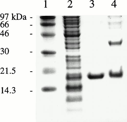 Fig. 2. SDS-PAGE of fractions obtained during purification of rhCDD and of cross-linked enzyme. Lanes from left: 1, molecular weight markers; 2, crude extract; 3, purified rhCDD; 4, cross-linked rhCDD. Proteins were visualized by Coomassie Blue staining.
