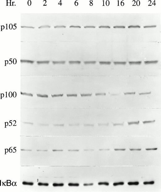 Fig. 1. NF-κB expression in GM-CSF–stimulated TF-1 cells. Whole cell lysates were prepared from growth factor–deprived TF-1 cells stimulated with GM-CSF for 0 to 24 hours. The protein content of 4 × 105 TF-1 cells was loaded in each lane of a 10% polyacrylamide gel. The membranes were blotted with anti-p50, anti-p52, anti-p65, or anti-IκBα antibodies and detected with ECL. A representative blot from one of five independent experiments is shown.
