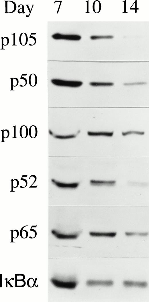 Fig. 4. NF-κB expression in day 7, 10, and 14 BFU-E–derived erythroblasts. Normal human BFU-E–derived erythroblasts were harvested at different days of differentiation and the whole cell lysate from 2 × 105 cells was loaded on each lane of a 10% polyacrylamide gel. Western blotting was performed with anti-p50, anti-p52, anti-p65, or anti-IκBα antibodies and detection with ECL. Five independent experiments were performed and a representative blot is shown.