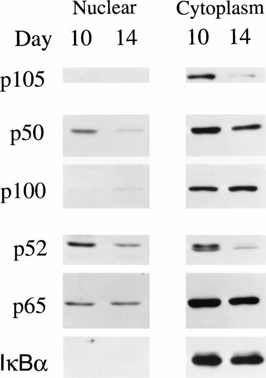 Fig. 5. NF-κB/Rel and IκBα in nuclear and cytoplasmic extracts of day 10 and 14 BFU-E–derived cells. Nuclear and cytoplasmic extracts were prepared from 1.5 × 107 day 10 or 14 BFU-E–derived cells. A total of 20 μg of nuclear or 15 μg of cytoplasmic extract was loaded on each lane of a 10% polyacrylamide gel and Western blotting performed with anti-p50, anti-p52, anti-p65, and anti-IκBα antibodies and ECL. Four experiments were performed with similar results.