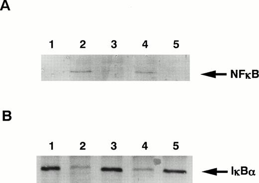 Fig. 7. Effect of shear stress on nuclear translocation of NFκB. (A) Nuclear extract of HUVECs was separated by sodium dodecyl sulfate-polyacrylamide gel electrophoresis (SDS-PAGE) and transferred to PVDF membrane by Western blotting. Then, p65 subunit of NFκB was detected with rabbit anti-p65 polyclonal antibody. (B) Cytoplasmic extract of HUVECs was separated by SDS-PAGE and transferred to PVDF membrane by Western blotting. Then, IκBα was detected with rabbit anti-IκBα polyclonal antibody. Lane 1, static control; lane 2, cells stimulated with TNF-α (100 U/mL) for 30 minutes; lane 3, cells exposed to shear stress at 18 dynes/cm2 for 15.5 hours; lane 4, cells exposed to shear stress at 18 dynes/cm2 for 15 hours and then stimulated with TNF-α (100 U/mL) and sheared for a further 30 minutes; lane 5, cells exposed to shear stress at 18 dynes/cm2 for 30 minutes.