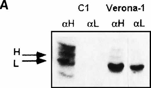 Fig. 2. Sequential immunoprecipitation experiments of metabolically labeled lymphoblastoid cells with antibodies specific for human ferritin H-chain (αH) and L-chain (αL). (A) Control cells (C1) and Verona-1 cells (Ver-1) were metabolically labeled with35S-methionine, lysed, and 2 × 106 cpm of the soluble fraction of homogenates precipitated with saturating amounts of anti-H chain antibody. The soluble fraction was then precipitated again with saturating amounts of anti–L-chain antibody. The precipitates were analyzed on SDS-PAGE under denaturing conditions and exposed to autoradiography. (B) Verona-1 cells were metabolically labeled with35S-methionine and immunoprecipitated as in (A), the pellets were resuspended in 4 mol/L urea, and separated on 6% polyacrylamide gels containing 4 mol/L urea under conditions that disrupt antibody antigen interactions without affecting ferritin structure. (C) As in (B), except that cells were metabolically labeled with 59FeNTA.