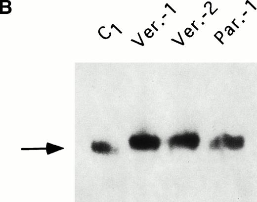 Fig. 3. 59Fe incorporation in lymphobastoid cells and ferritin. (A) Cells were incubated for 18 hours in RPMI supplemented with 10 μmol/L 59FeNTA and 200 μmol/L ascorbic acid, washed, and the radioactivity in the soluble homogenates counted. The values were normalized on the data of the control cells. Means and standard deviation (SD) of three independent experiments are shown. (B) The soluble homogenates from the same number of cells were subjected to electrophoresis under nondenaturing conditions and exposed to autoradiography. Ferritin mobility is indicated by the arrow. (C) Means and SD of densitometometric quantitation of three independent experiments, as in (B), are shown. Values normalized on the control cells.