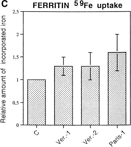 Fig. 3. 59Fe incorporation in lymphobastoid cells and ferritin. (A) Cells were incubated for 18 hours in RPMI supplemented with 10 μmol/L 59FeNTA and 200 μmol/L ascorbic acid, washed, and the radioactivity in the soluble homogenates counted. The values were normalized on the data of the control cells. Means and standard deviation (SD) of three independent experiments are shown. (B) The soluble homogenates from the same number of cells were subjected to electrophoresis under nondenaturing conditions and exposed to autoradiography. Ferritin mobility is indicated by the arrow. (C) Means and SD of densitometometric quantitation of three independent experiments, as in (B), are shown. Values normalized on the control cells.