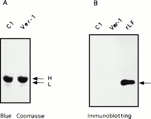 Fig. 4. Analysis of the insoluble fraction of lens extracts. SDS-PAGE of the insoluble fraction of homogenates from lens specimens of a control (C1) and Verona-1 subject (Ver-1). (A) Coomassie blue stain of the precipitates. (B) Immunoblotting stained with anti-L ferritin antibody of the two insoluble fractions and a control of recombinant L ferritin (rLF). The arrows indicate the mobility of H and L chains.
