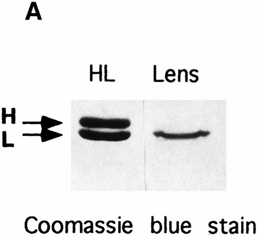 Fig. 5. Electrophoretic analyses of ferritin purified from HHCS lens. (A) SDS-PAGE of the purified ferritin compared with human H and L ferritin chains, Coomassie blue stain. (B) Nondenaturing PAGE of the purified lens ferritin compared with recombinant H and L ferritins, Coomassie blue stain. (C) The same as in (B), except that ferritins were preincubated with Fe(II) (1,000 Fe atoms per molecule, pH 7.0) and the gels stained with Prussian Blue.