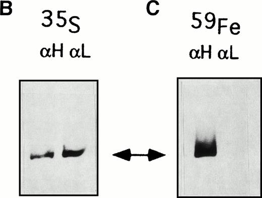 Fig. 2. Sequential immunoprecipitation experiments of metabolically labeled lymphoblastoid cells with antibodies specific for human ferritin H-chain (αH) and L-chain (αL). (A) Control cells (C1) and Verona-1 cells (Ver-1) were metabolically labeled with35S-methionine, lysed, and 2 × 106 cpm of the soluble fraction of homogenates precipitated with saturating amounts of anti-H chain antibody. The soluble fraction was then precipitated again with saturating amounts of anti–L-chain antibody. The precipitates were analyzed on SDS-PAGE under denaturing conditions and exposed to autoradiography. (B) Verona-1 cells were metabolically labeled with35S-methionine and immunoprecipitated as in (A), the pellets were resuspended in 4 mol/L urea, and separated on 6% polyacrylamide gels containing 4 mol/L urea under conditions that disrupt antibody antigen interactions without affecting ferritin structure. (C) As in (B), except that cells were metabolically labeled with 59FeNTA.