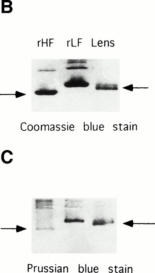 Fig. 5. Electrophoretic analyses of ferritin purified from HHCS lens. (A) SDS-PAGE of the purified ferritin compared with human H and L ferritin chains, Coomassie blue stain. (B) Nondenaturing PAGE of the purified lens ferritin compared with recombinant H and L ferritins, Coomassie blue stain. (C) The same as in (B), except that ferritins were preincubated with Fe(II) (1,000 Fe atoms per molecule, pH 7.0) and the gels stained with Prussian Blue.