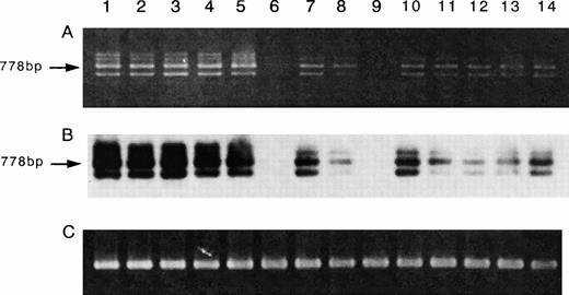 Fig. 7. Expression of the mRNA of IL-15R α on ATL cell lines. RT-PCR for IL-15R α mRNA (A) and Southern blot analysis of the products (B), and RT-PCR for β-actin mRNA as a control of PCR products (C) were performed. The results indicated that all four ATL cell lines (lane 2, SO4; lane 3, ST1; lane 4, KK1; lane 5, OMT) had the mRNA of IL-15R α (778 bp). Three samples of fresh ATL cells (lanes 7, 8, and 10) had smaller amounts of the mRNA equivalent to those of the resting normal PBMC (lanes 11 through 14). One sample of fresh ATL cells (lane 9) and the HL-60 cells (lane 6) did not have the IL-15R α mRNA. The activated normal PBMC (lane 1) had an amount of the mRNA larger than that of the resting PBMC.