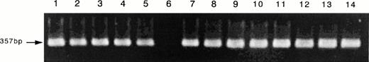Fig. 8. Expression of the mRNA of IL-15 on the ATL cell lines. Using the same RNA used for IL-15R α, the RT-PCR for IL-15 mRNA was done. The results showed that the four ATL cell lines (lane 2, SO4; lane 3, ST1; lane 4, KK1; lane 5, OMT), the fresh ATL cells (lanes 7 through 10), the activated PBMC (lane 1), and the resting PBMC (lanes 11 through 14) had almost identical amounts of IL-15 mRNA. The activation of PBMC did not cause an increase of the mRNA. HL-60 (lane 6) did not have any IL-15 mRNA.