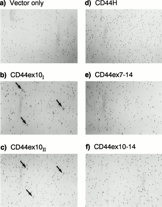 Fig. 3. CD44ex10 transfectants exhibit a subtle increase in homotypic aggregation in vitro. Two independently derived representative CD44ex10–containing Namalwa transfectants (CD44ex10I and II) and additional representative CD44H, CD44ex7-14, CD44ex10-14, and vector-only transfectants are shown. The directly spliced CD44ex10–containing Namalwa transfectants exhibited a subtle increase in homotypic aggregation that was not apparent in other CD44 or vector-only transfectants.