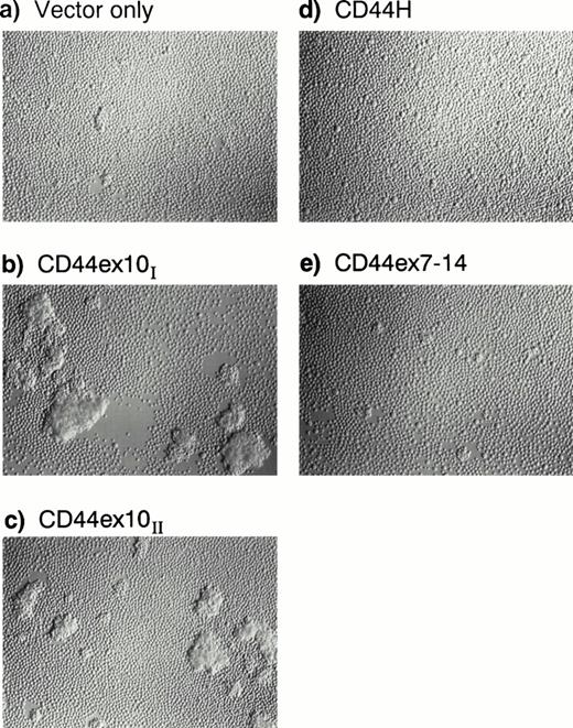 Fig. 7. Cells derived from CD44ex10 local tumors exhibit increased homotypic aggregation in vitro. Single-cell suspensions of the CD44ex10 local tumors and the less common vector-only, CD44H, CD44ex7-14, and CD44ex10-14 local tumors were prepared, plated, cultured, and monitored for changes in cellular morphology and aggregation in vitro. Cell suspensions from local tumors of representative independently derived CD44ex10 Namalwa transfectants (I or II) or vector-only, CD44H, and CD44ex7-14 transfectants are shown. As indicated, cell suspensions from CD44ex10 local tumors exhibited dramatically increased homotypic aggregation.