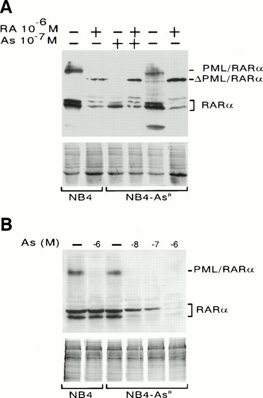 Fig. 4. Western blot analysis of PML/RARα and RARα expression in NB4 and NB4-AsR cells. (A) NB4 cells were treated for 1 day with medium alone or 10−6 mol/L RA. NB4-AsR cells were grown continuously in 10−7mol/L As2O3, then washed with medium and treated for 1 day with 10−7 mol/L As2O3, 10−6 mol/L RA plus 10−7 mol/L As2O3 or grown for 2 weeks without As2O3 and treated for 1 day with medium alone or 10−6 mol/L RA. ▵PML/RARα indicates a cleavage product of PML/RARα. (B) NB4 cells were treated for 1 day with medium alone or 10−6 mol/L As2O3. NB4-AsR cells were treated for 1 week with medium alone, As2O3 at 10−6 mol/L, 10−7 mol/L, 10−8mol/L. CBB waived gels are shown below to ensure equal protein loading.