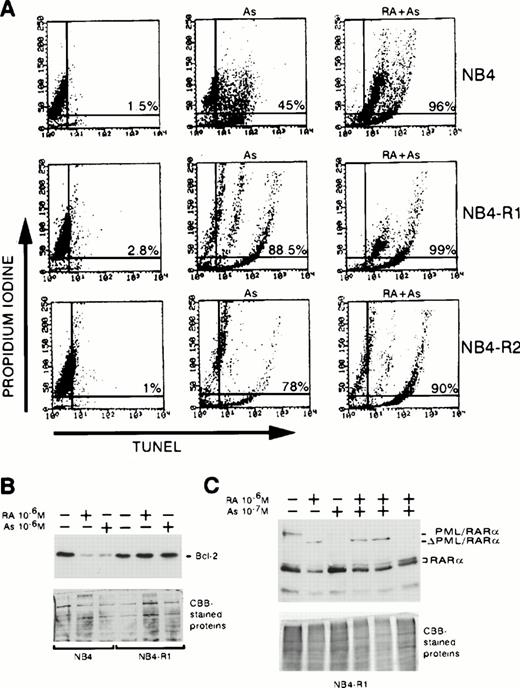 Fig. 9. (A) Effect of As2O3and/or RA on NB4, NB4-R1, and NB4-R2 cell apoptosis. NB4, NB4-R1, and NB4-R2 were treated for 3 days with 10−6mol/L As2O3 or 10−6 mol/L RA, as indicated. Apoptosis was determined, after a TUNEL assay and PI-staining, by flow cytometry, and the % of apoptotic cells is reported in the plots. The abscissa of the plot represents TUNEL (apoptosis) and the ordinate represents PI (DNA quantity). (B) Western blot analysis of Bcl-2 in NB4 and NB4-R1 cells. Cells were grown for 48 hours in the presence of the indicated treatments. (C) Effect of As2O3 and/or RA on PML/RARα and RARα expression in NB4-R1 cells. The cells were treated for 2 days with either medium, 10−6 mol/L RA, 10−7mol/L As2O3, or the combination of 10−6 mol/L RA plus 10−7 mol/L As2O3. The two right lanes represent sequential treatments: 10−6 mol/L RA for 1 day followed by 10−7 mol/L As2O3 for the next day or 10−7 mol/L As2O3 for 1 day followed by 10−6 mol/L RA for the next day (far right lane).