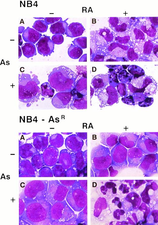 Fig. 2. Morphologic features of NB4 and NB4-AsR cell lines on RA, As2O3 or the combined treatment. NB4 and NB4-AsR cells were treated for 5 days, respectively, without (A), with 10−6 mol/L RA (B), 10−6 mol/L As2O3 (C) or with the combination of 10−6 mol/L RA plus 10−6mol/L As2O3 (D).