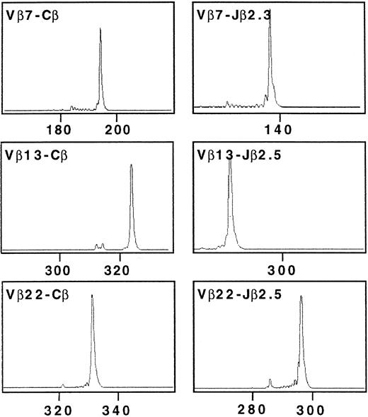 Fig. 2. Complementarity-determining region 3 (CDR3) size analysis of TCR Vβ7, Vβ13, and Vβ22 transcripts in Cou-LS tumor cell line analyzed with fluorescent Cβ, Jβ2.3, and Jβ2.5. cDNA made from total RNA extracted from Cou-LS were amplified in a PCR reaction primed by Vβ7/Vβ13/Vβ22 and Cβ-specific primers. The unlabeled amplification products were elongated with nested fluorescent Cβ, Jβ2.3, and Jβ2.5. Aliquots were subjected to electrophoresis and analysis on an automated sequencer. Cou-LS tumor cell line showed three TCR β transcripts corresponding to Vβ7/Jβ2.3, Vβ13/Jβ2.5, and Vβ22/Jβ2.5.