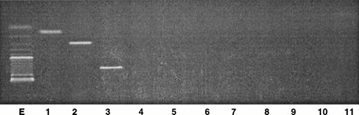 Fig. 4. Analysis of the PCR products obtained from genomic DNA in the skin tumor. Two microliters of the DNA sample were amplified with a 30-cycle PCR, using primers specific for Vβ genes in combination with Jβ primers. The PCR products were analyzed by electrophoresis through a 2% agarose gel. Lane E, size markers (100 bp); lane 1, Vβ7/Jβ2.3; lane 2, Vβ13/Jβ2.5; lane 3, Vβ22/Jβ2.5; lane 4, Vβ5/Jβ1.1; lane 5, Vβ5/Jβ1.2; lane 6, Vβ5/Jβ2.1; lane 7, Vβ5/Jβ2.7; lane 8, Vβ8/Jβ1.1; lane 9, Vβ8/Jβ1.2; lane 10, Vβ8/Jβ2.1; lane 11, Vβ8/Jβ2.7.