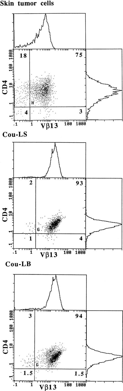 Fig. 5. Expression of Vβ13 on fresh skin tumor cells and on both cultured T-cell lines Cou-LS and Cou-LB. Double immunostaining flow-cytometric analysis was performed, using a PE-conjugated anti-CD4 MoAb, and an anti-Vβ13 MoAb plus an FITC-conjugated goat anti-mouse Ig.