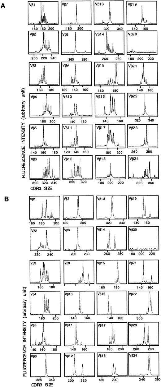Fig. 8. Vβ-Cβ VDJ junction CDR3-size distribution profiles in skin tumor (A) and PBL (B) from patient Cou. cDNA made from total RNA extracted from the tumor biopsy sample or the PBL was subjected to PCR amplification with Vβ-specific primers and a fluorescent Cβ primer. The labeled PCR products were subjected to electrophoresis and analysis on an automated DNA sequencer. The fluorescence profiles (x-axis, Vβ-Cβ size in nucleotides; y-axis, fluorescence intensity) of the 24 Vβ subfamilies are shown.