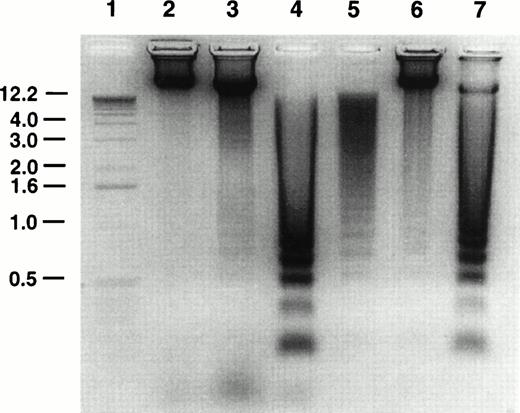 Fig. 2. Agarose gel electrophoresis of Molt-4 DNA. Molt-4 cells were untreated or treated with 8 nmol/L GW1843 for 48 hours and purified live, blebbed, and dead cell populations isolated on histopaque gradients as described in Materials and Methods. Cellular DNA was prepared and resolved by electrophoresis in 1% agarose gels gel as described in Materials and Methods. Lane 1, one kb ladder; lane 2, live fraction from untreated control cells after resolution by histopaque gradients; lane 3, GW1843-treated, normal-appearing cells after histopaque gradients (fraction contains approximately 6% dead cells); lane 4, GW1843-treated, blebbed cells after gradients; lane 5, GW1843-treated, dead cells after gradients; lane 6, untreated cells before gradients (fraction contains 93% normal cells and 7% dead cells); lane 7, GW1843-treated cells before gradients (26% normal cells, 52% blebbed, and 22% dead). The gel is from a representative experiment from three separate determinations.