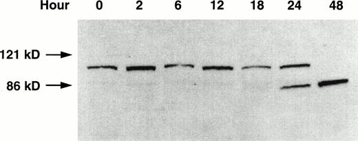 Fig. 3. Western blot of PARP proteolysis on treatment of Molt-4 cells with GW1843. Molt-4 cells in log-phase growth were treated with 8 nmol/L GW1843 and aliquots of 2 × 106 cells were taken at the indicated times. Cells were prepared for electrophoresis, electrophoresed on 7.5% polyacrylamide SDS gels,29 and blotted onto nitrocellulose as described in Materials and Methods. The blot is an x-ray film image of PARP protein detected with a horseradish peroxidase-conjugated secondary antibody visualized with chemiluminescent substrate (Amersham) blotted as described in Materials and Methods. The Mr values were determined by running prestained Mr markers (BioRad). Intact PARP (upper band) is Mr 116,000 and the proteolytic fragment is Mr 85,000. This blot is from a representative experiment from four separate determinations.