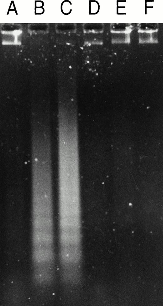Fig. 8. Effect of the caspase 3 inhibitor Ac-DEVD-CHO on GW1843-generated apoptotic DNA. (Left) Log-phase Molt-4 cells were treated for 48 hours with GW1843 alone or in combination with 50 μmol/L Ac-DEVD-CHO. Cells were harvested, DNA fragments isolated, and resolved using agarose gel electrophoresis as described in Materials and Methods. Lanes A, B, and C were treated with 0, 8, and 16 nmol/L GW1843, respectively. Lanes D, E, and F were treated with 0, 8, and 16 nmol/L GW1843, respectively, in the presence of 50 μmol/L Ac-DEVD-CHO. This gel is from a representative experiment from three separate determinations. (Right) Log-phase Molt-4 cells were treated for 48 hours as described below and prepared for FACS analysis as described in Materials and Methods. Cells were treated as follows: (A), mock treated cells; (B), 50 μmol/L Ac-DEVD-CHO; (C), 8 nmol/L GW1843; and (D), 8 nmol/L GW1843 with 50 μmol/L Ac-DEVD-CHO.