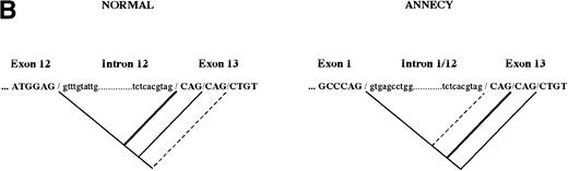 Fig. 2. Reticulocyte mRNA analysis. (A) 5′RACE on reticulocyte mRNA, using the pairs of primers I/IX (left side) and I/X (right side). C, control; I.2, proposita. The PCR products are schematically represented and their sizes in basepairs are shown. For schematic representation of exons, see Fig 1. (B) Use of internal cryptic splicing sites within exon 13. Sequencing analysis performed on RT-PCR products derived from normal12 or 4.1 Annecy (this report) mRNAs showed discrete use of cryptic acceptor sites within exon 13. The several sequences obtained from 4.1 Annecy tend to suggest a different pattern of use of these sites. () Major site; (—) secondary site; (---) site not used. Intronic and exonic sequences are represented in lowercase and capital bolded letters, respectively.